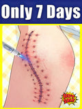 Skin Tightening